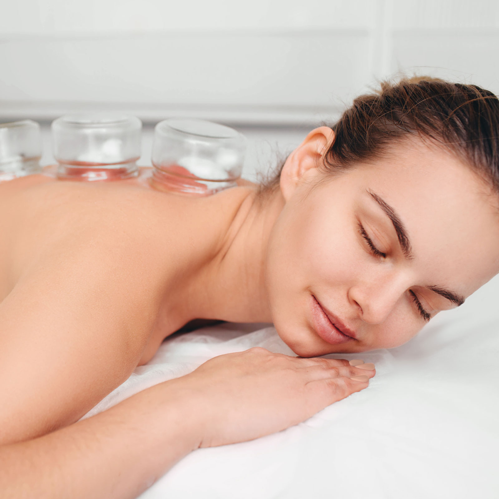 acupuncture cups
